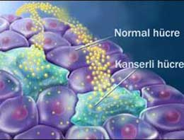 Kanserin işaretçisi 5 ağrı